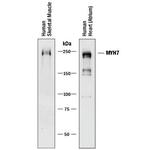 MYH7 Monoclonal Antibody (940906)