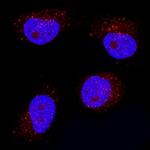 IFN epsilon Monoclonal Antibody (995728)