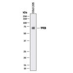 TFEB Antibody in Western Blot (WB)