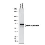 MMP14 Monoclonal Antibody (5H2)