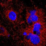 ORM2 Monoclonal Antibody (959445)