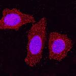 HIPK2 Monoclonal Antibody (493918)