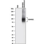 BDKRB2 Monoclonal Antibody (471902)