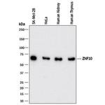ZNF10 Monoclonal Antibody (980809)