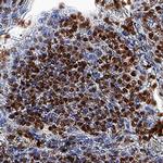 ZNF10 Monoclonal Antibody (980803)