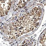 DNAH17 Monoclonal Antibody (981717)