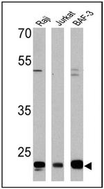 CD58 Antibody in Western Blot (WB)