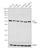 E2F4 Antibody in Western Blot (WB)