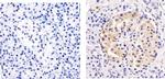 GLUT1 Antibody in Immunohistochemistry (Paraffin) (IHC (P))