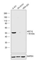 Cytokeratin 15 Antibody in Western Blot (WB)