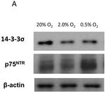 14-3-3 sigma Antibody in Western Blot (WB)