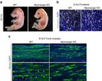 Myosin Skeletal Muscle Antibody in Immunohistochemistry (IHC)