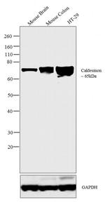 Caldesmon Antibody in Western Blot (WB)