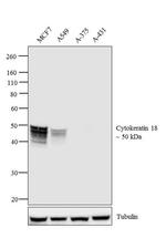 Cytokeratin 18 Antibody
