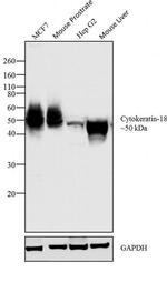 Cytokeratin 18 Antibody in Western Blot (WB)