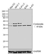 Cytokeratin HMW Antibody in Western Blot (WB)