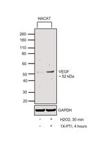 VEGF Antibody