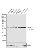 PGP9.5 Antibody in Western Blot (WB)