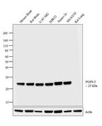 PGP9.5 Antibody in Western Blot (WB)