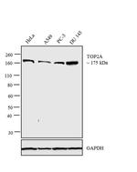 TOP2A Antibody in Western Blot (WB)