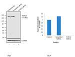 TOP2A Antibody in Western Blot (WB)