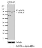 Phospho-Rb (Ser608) Antibody in Western Blot (WB)
