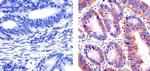 EpCAM Antibody in Immunohistochemistry (Paraffin) (IHC (P))