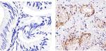 EpCAM Antibody in Immunohistochemistry (Paraffin) (IHC (P))