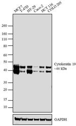 Cytokeratin 19 Antibody in Western Blot (WB)
