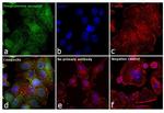 Progesterone Receptor Antibody