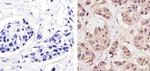 Cyclin D1 Antibody in Immunohistochemistry (Paraffin) (IHC (P))