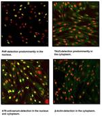 Tau Antibody in Immunocytochemistry (ICC/IF)
