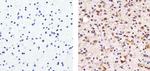 Tau Antibody in Immunohistochemistry (Paraffin) (IHC (P))