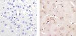 Tau Antibody in Immunohistochemistry (Paraffin) (IHC (P))