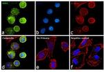 ErbB2 (HER-2) Antibody