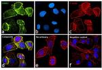 ErbB2 (HER-2) Antibody