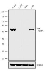 Syk Antibody in Western Blot (WB)