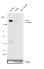 ErbB2 (HER-2) Antibody in Western Blot (WB)