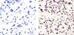 Cyclin B1 Antibody in Immunohistochemistry (Paraffin) (IHC (P))