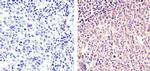 Cyclin B1 Antibody in Immunohistochemistry (Paraffin) (IHC (P))