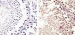 Cyclin B1 Antibody in Immunohistochemistry (Paraffin) (IHC (P))