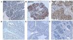 Estrogen Receptor alpha Antibody in Immunohistochemistry (IHC)