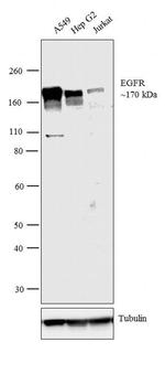 EGFR Antibody in Western Blot (WB)