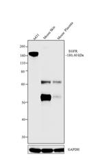 EGFR Antibody in Western Blot (WB)