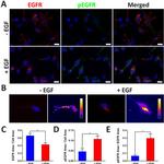 EGFR Antibody in Immunocytochemistry (ICC/IF)