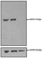 EGFR Antibody in Western Blot (WB)