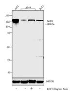 EGFR Antibody in Western Blot (WB)