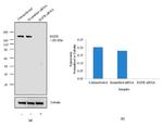 EGFR Antibody in Western Blot (WB)