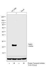 TIMP2 Antibody