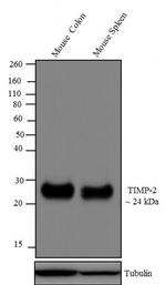 TIMP2 Antibody in Western Blot (WB)